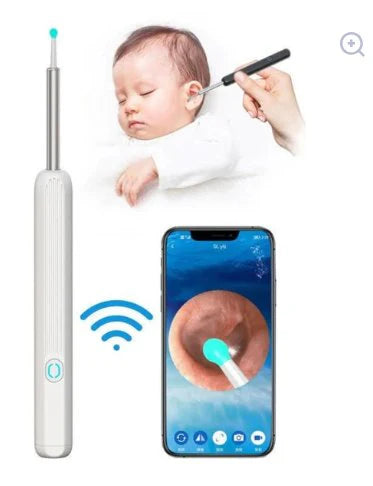 Smart Visual Earwax Removal Kit – See & Clean Safely at Home 👂📱
