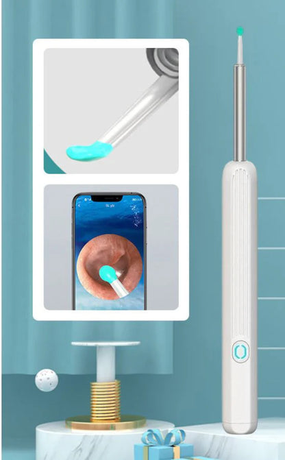 Smart Visual Earwax Removal Kit – See & Clean Safely at Home 👂📱